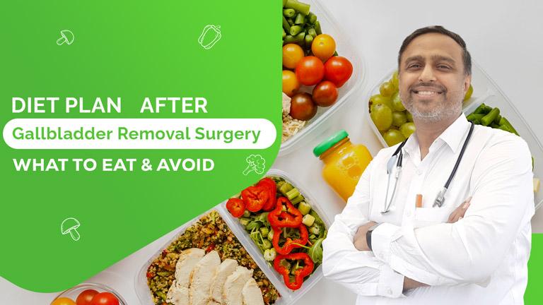 Diet plan after gallbladder removal surgery