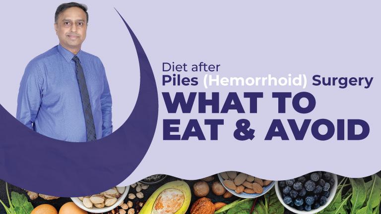 Diet Plan After Piles Hemorrhoid Surgery What Foods To Eat Avoid diet-plan-after-piles-hemorrhoid-surgery-what-foods-to-eat-avoid